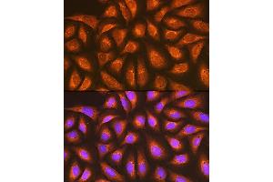 anti-RAP1A + RAP1B antibody