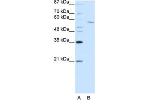 Western Blotting (WB) image for anti-REST Corepressor 1 (RCOR1) antibody (ABIN2461866) (CoREST anticorps)