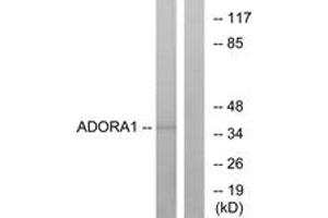 Western blot analysis of extracts from MCF-7 cells, using ADORA1 Antibody. (ADORA1 anticorps  (AA 277-326))