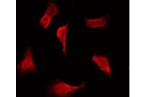 ABIN6276004 staining COLO205 by IF/ICC. (GPR114 anticorps  (Internal Region))