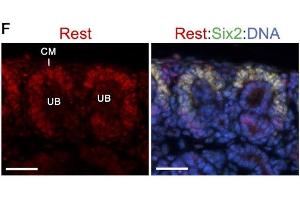 Co-immunostaining for anti-Rest (red) and Six2 (green) showing higher expression levels of Rest in Six2+ cap mesenchyme (CM) surrounding ureteric bud (UB). (REST anticorps  (AA 401-450))