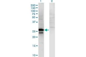 Western Blot analysis of SP2 expression in transfected 293T cell line by SP2 monoclonal antibody (M01), clone 5D3. (Sp2 anticorps  (AA 71-161))