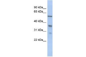WB Suggested Anti-SLC38A2 Antibody Titration:  0. (SLC38A2 anticorps  (N-Term))