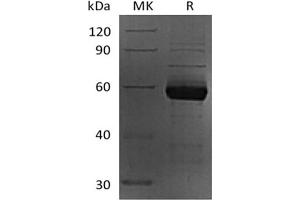 Western Blotting (WB) image for Sialic Acid Binding Ig-Like Lectin 15 (SIGLEC15) (Active) protein (mFc Tag) (ABIN7319766)