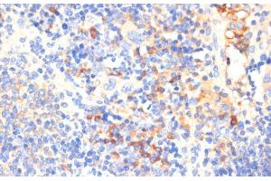 Immunohistochemistry of paraffin-embedded Mouse spleen using WNK3 Polyclonal Antibody at dilution of 1:100 (40x lens). (WNK3 anticorps)