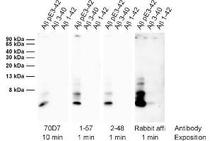 Detection of different synthetic Abeta species (dilution 1 : 1000). (Abeta-pE3 anticorps)