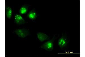 Immunofluorescence of monoclonal antibody to PHLDA1 on HeLa cell. (PHLDA1 anticorps  (AA 1-109))