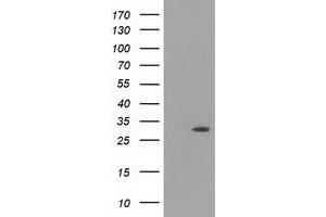 Western Blotting (WB) image for anti-Hydroxyacylglutathione Hydrolase-Like (HAGHL) antibody (ABIN1498572) (HAGHL anticorps)