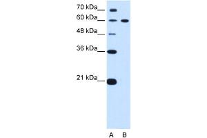 WB Suggested Anti-DTX2 Antibody Titration:  0. (DTX2 anticorps  (C-Term))