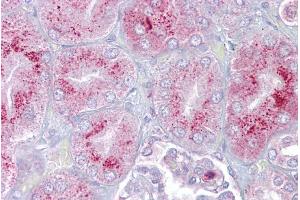 Immunohistochemistry with Kidney tissue at an antibody concentration of 5µg/ml using anti-P2RX2 antibody (ARP35436_P050) (P2RX2 anticorps  (N-Term))