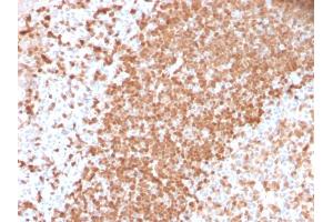Formalin-fixed, paraffin-embedded human Tonsil stained with TCL1 Recombinant Rabbit Monoclonal Antibody (TCL1/2747R). (Recombinant TCL1A anticorps  (AA 2-109))