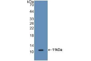 Detection of Recombinant S100A8, Mouse using Polyclonal Antibody to S100 Calcium Binding Protein A8 (S100A8) (S100A8 anticorps  (AA 1-89))