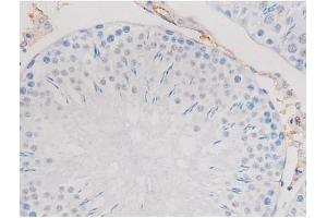 ABIN6267487 at 1/200 staining Rat testis tissue sections by IHC-P. (alpha Adducin anticorps  (pSer726))