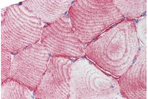 Human Skeletal Muscle (formalin-fixed, paraffin-embedded) stained with TEAD1 antibody ABIN462220 followed by biotinylated goat anti-rabbit IgG secondary antibody ABIN481713, alkaline phosphatase-streptavidin and chromogen.