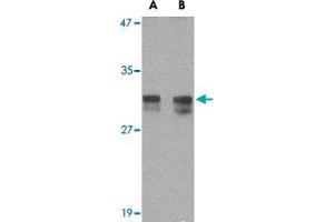 Western blot analysis of RASD2 in rat colon tissue lysate with RASD2 polyclonal antibody  at (A) 1 and (B) 2 ug/mL .