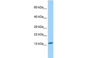 Western Blotting (WB) image for anti-Fast Skeletal Troponin C (TNNC2) (N-Term) antibody (ABIN2790315) (TNNC2 anticorps  (N-Term))
