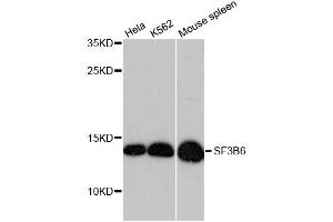 Western blot analysis of extracts of various cell lines, using SF3B6 antibody (ABIN6290152) at 1:3000 dilution. (Pre-mRNA Branch Site Protein p14 (SF3B14) anticorps)