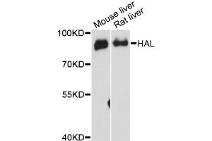 Western blot analysis of extracts of various cell lines, using HAL antibody (ABIN6292128) at 1:3000 dilution. (HAL anticorps)