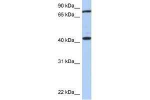 WB Suggested Anti-TEX9 Antibody Titration: 0. (TEX9 anticorps  (Middle Region))