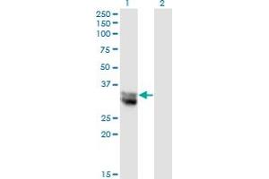 Western Blot analysis of NIT1 expression in transfected 293T cell line by NIT1 monoclonal antibody (M01), clone 1C3. (Nitrilase 1 anticorps  (AA 228-327))