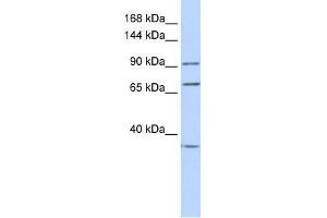 EEF2 antibody used at 1 ug/ml to detect target protein. (EEF2 anticorps  (N-Term))