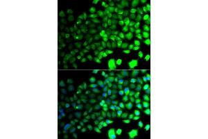 Immunofluorescence analysis of A549 cells using PRKAA2 antibody. (PRKAA2 anticorps  (AA 343-552))