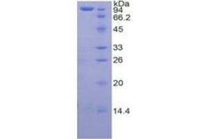 SDS-PAGE of Protein Standard from the Kit (Highly purified E.