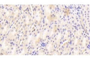 Detection of CRAT in Mouse Kidney Tissue using Polyclonal Antibody to Carnitine Acetyltransferase (CRAT)
