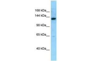 Image no. 1 for anti-MN1 proto-oncogene (MN1) (AA 1249-1298) antibody (ABIN6748132) (Meningioma 1 anticorps  (AA 1249-1298))