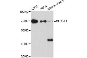 Western blot analysis of extracts of various cell lines, using SLC5A1 Antibody (ABIN5998870) at 1/1000 dilution. (SLC5A1 anticorps)