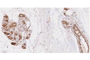 Immunohistochemistry (IHC) image for anti-Ubiquitin-Conjugating Enzyme E2L 6 (UBE2L6) (AA 1-152), (N-Term) antibody (ABIN317574)