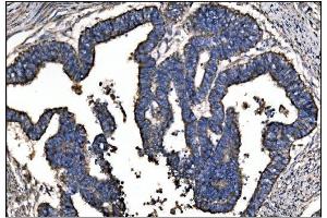 IHC analysis of Ornithine Aminotransferase/OAT using anti-Ornithine Aminotransferase/OAT antibody (ABIN7600649). (OAT anticorps  (AA 214-439))