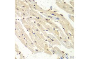 Immunohistochemistry of paraffin-embedded mouse heart using PSME1 antibody (ABIN1876546) at dilution of 1:100 (40x lens). (PSME1 anticorps)