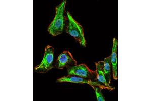 Immunofluorescence analysis of HepG2 cells using MELK antibody (green).