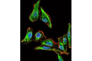 Immunofluorescence analysis of HepG2 cells using MELK antibody (green).