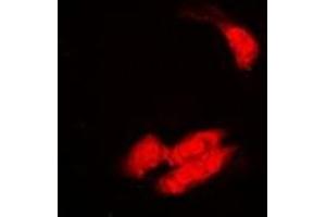 Immunofluorescent analysis of SULT2B1 staining in A549 cells. (SULT2B1 anticorps)