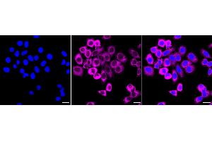 Immunocytochemical staining of HepG2 cells with Fragile X messenger ribonucleoprotein 1 antibody (ABIN7800930), 1:1,000).