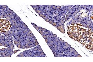 Detection of CK7 in Rat Pancreas Tissue using Polyclonal Antibody to Cytokeratin 7 (CK7) (Cytokeratin 7 anticorps  (AA 91-394))