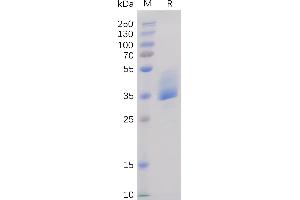 Human BAFF-R Protein, mFc Tag on SDS-PAGE under reducing condition.
