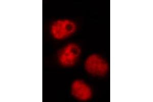 ABIN6268905 staining HeLa by IF/ICC. (OCT4 anticorps  (Internal Region))