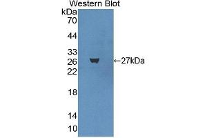 Detection of Recombinant BNC1, Human using Polyclonal Antibody to Basonuclin 1 (BNC1) (Basonuclin 1 anticorps  (AA 43-246))