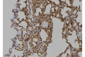 ABIN6268990 at 1/100 staining Mouse lung tissue by IHC-P. (PPP1R12A anticorps  (C-Term))