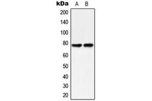 Western blot analysis of PKC delta (pY313) expression in HeLa (A), MCF7 Caylculin A-treated (B) whole cell lysates. (PKC delta anticorps  (pTyr313))