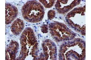 Immunohistochemical staining of paraffin-embedded Human breast tissue using anti-EPN2 mouse monoclonal antibody. (Epsin 2 anticorps)