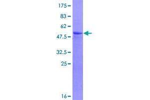Image no. 1 for Ring Finger and CHY Zinc Finger Domain Containing 1, E3 Ubiquitin Protein Ligase (RCHY1) (AA 1-252) protein (GST tag) (ABIN1317696)