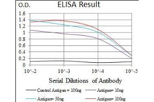 Black line: Control Antigen (100 ng), Purple line: Antigen(10 ng), Blue line: Antigen (50 ng), Red line: Antigen (100 ng), (Intestinal Alkaline Phosphatase anticorps  (AA 397-458))