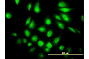 Immunofluorescence of monoclonal antibody to FLJ23356 on HeLa cell.
