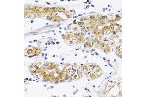 Immunohistochemistry of paraffin-embedded human stomach using NPPA antibody.