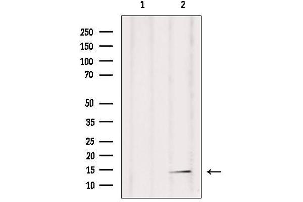 POLR2F anticorps  (N-Term)