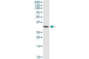 HADH MaxPab rabbit polyclonal antibody. (HADH anticorps  (AA 1-314))